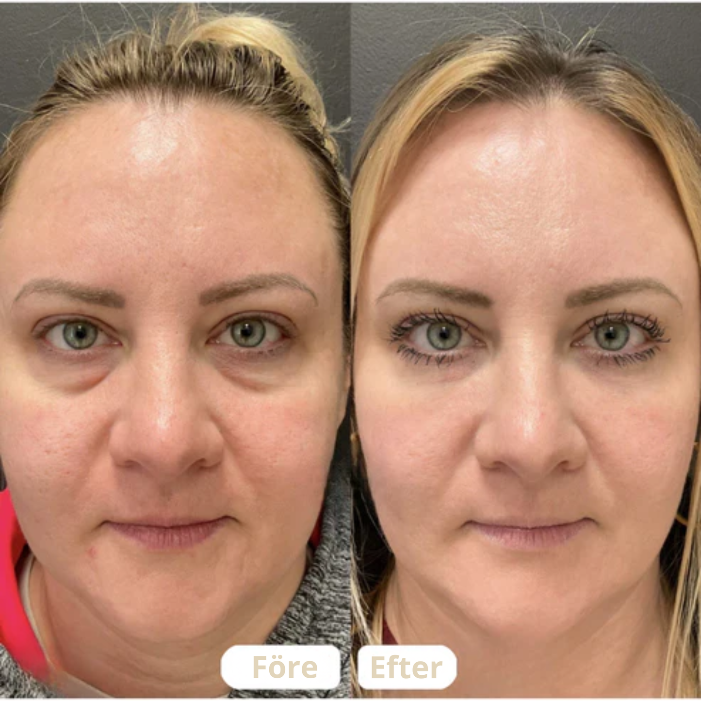 Lymfborste – För Ansiktskontur och Lymfdränering