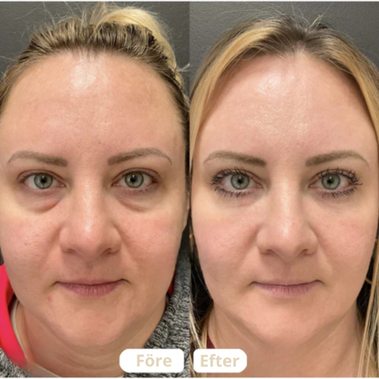 Lymfborste – För Ansiktskontur och Lymfdränering